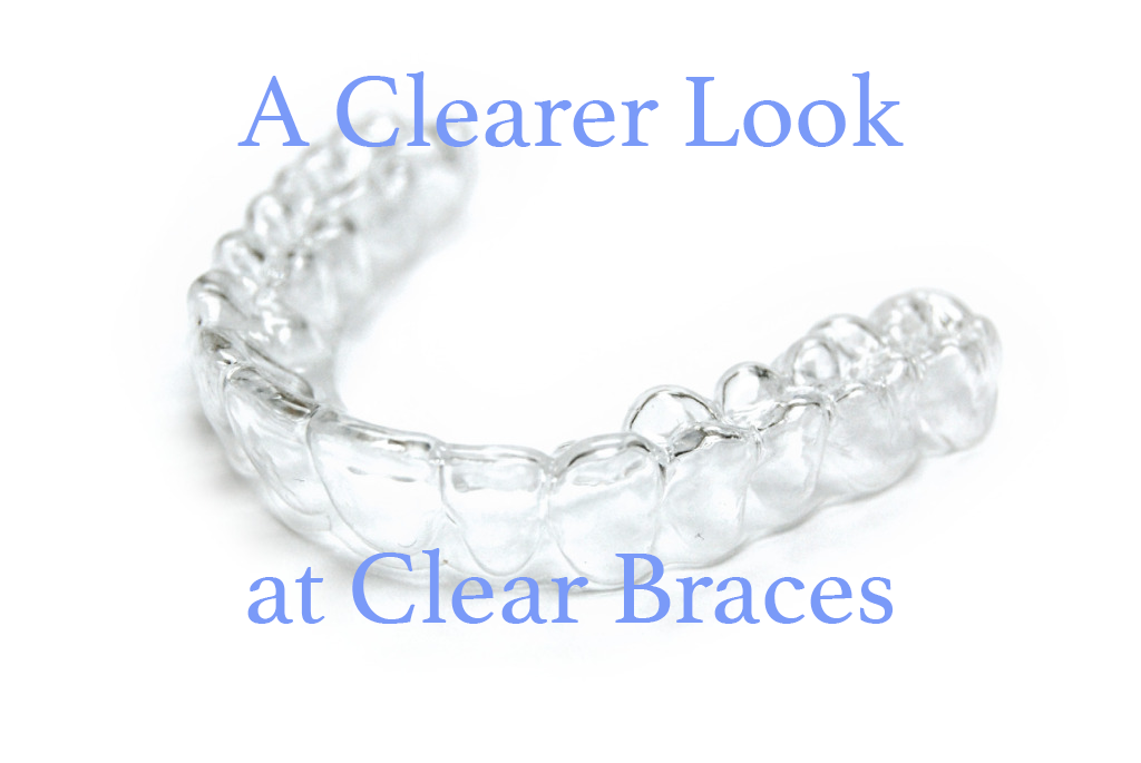 Waupaca Dentist Clear Braces
