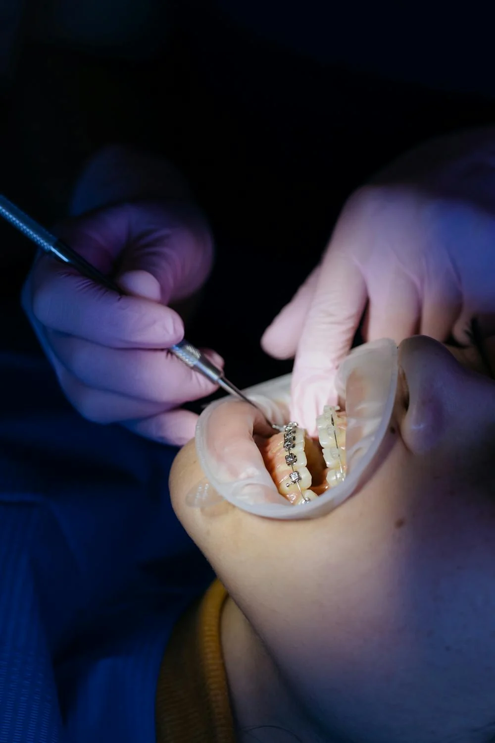 pexels-photo-6529115 Teeth Straightening with Waupaca Dentist