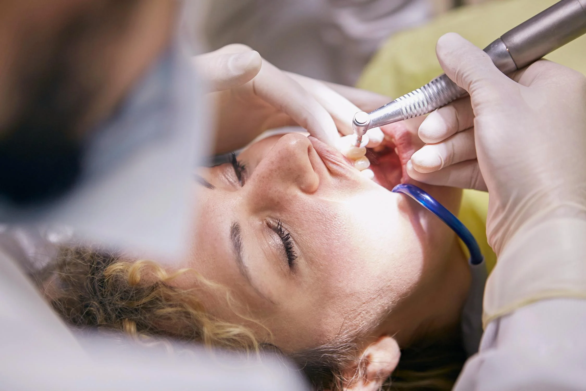 pexels-photo-3779706 (2) Full-Mouth Rehabilitation with Waupaca Dentist